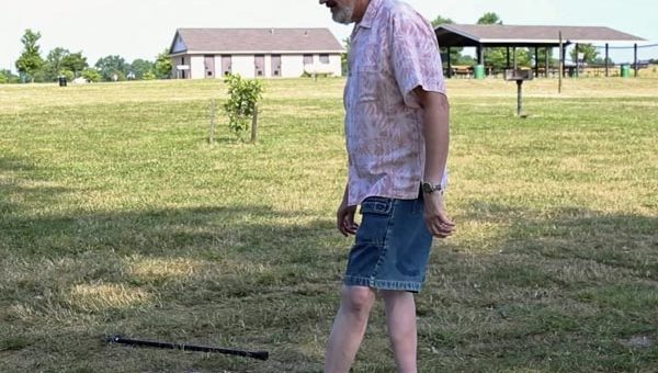 Moses Lanham, Manusia Elastik yang Boleh Putar Kakinya 180 Darjah sambil Berjalan Kebelakang