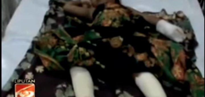 Aneh – Puluhan Paku Didalam Tubuh Budak 3 Tahun