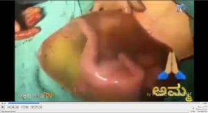 Bayi dalam perut