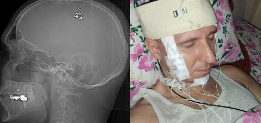 Saintis Dakwa Telah Melakukan Pembedahan Otak Pada Dirinya Di Ruang Tamunya